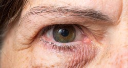 Optičarka otkrila šest načina na koje oči mogu upozoriti na opasne probleme