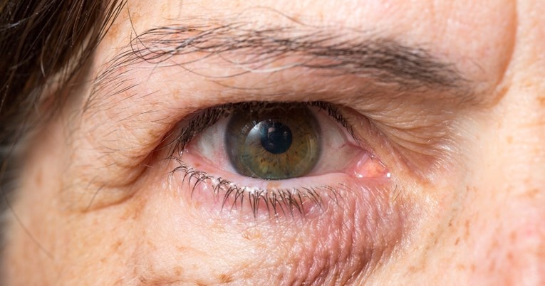 Optičarka otkrila šest načina na koje oči mogu upozoriti na opasne probleme