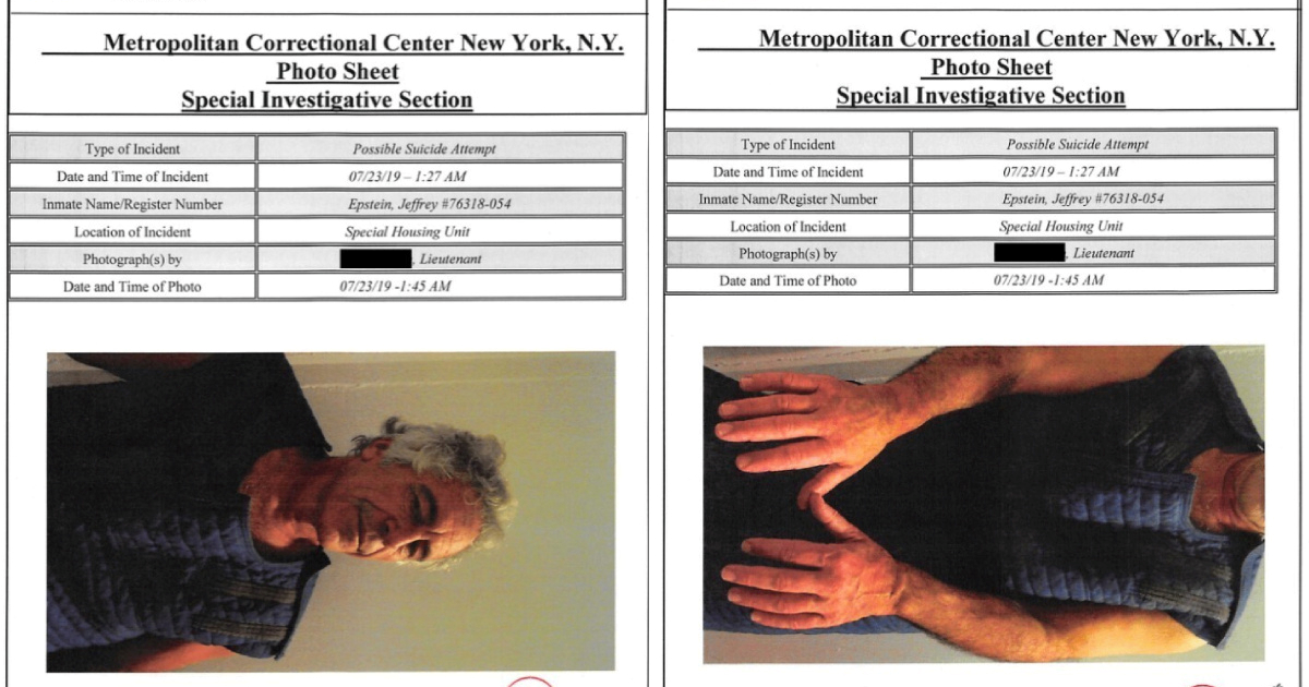 Objavljene nove fotografije Epsteina nakon prvog pokušaja samoubojstva
