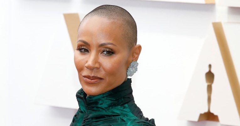 Što je alopecija, stanje zbog kojeg Jada Pinkett Smith gubi kosu?