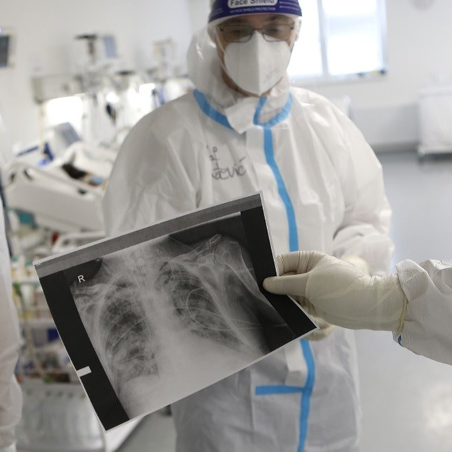 U Srbiji od posljedica korone umrle 63 osobe, dvije bebe na respiratoru