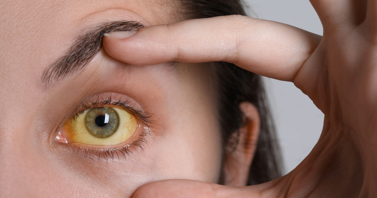 Tri simptoma koja ukazuju na moguće probleme s jetrom