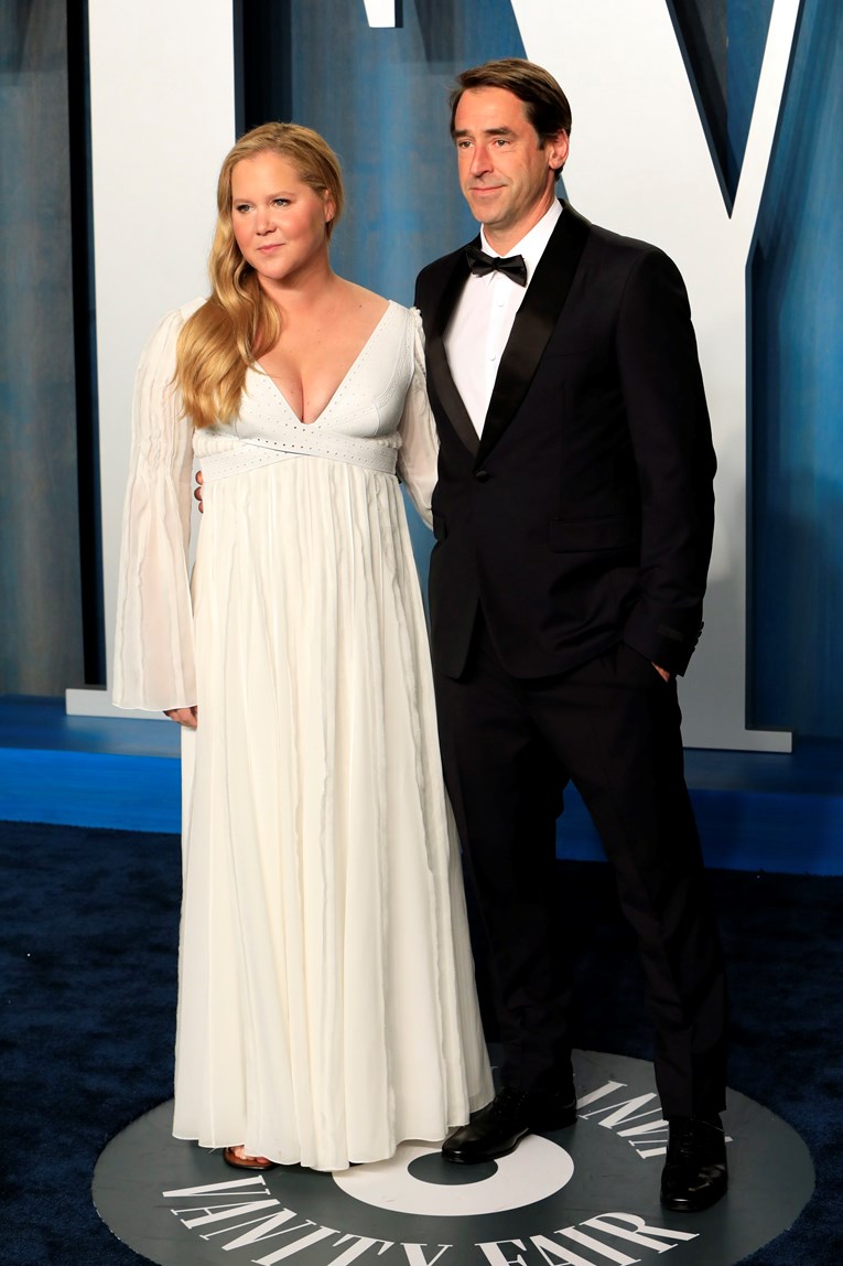 Amy Schumer objavila da se razvodi: "Ne zato što sam smršavjela"