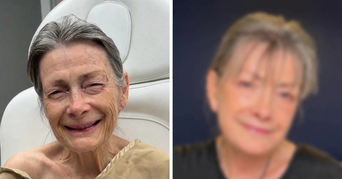 Viralna transformacija: 70-godišnjakinja izgleda 30 godina mlađe nakon faceliftinga
