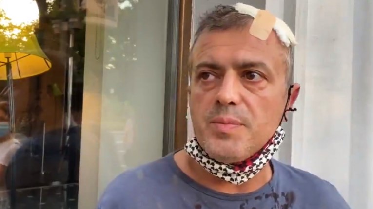 VIDEO Sergej Trifunović napadnut na prosvjedu, ozlijeđen je