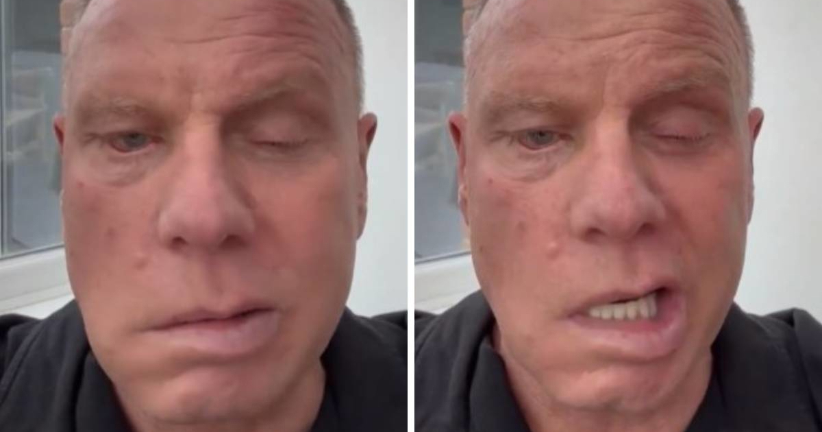 VIDEO Bivši kapetan Cityja progovorio o bolesti koja mu je deformirala lice