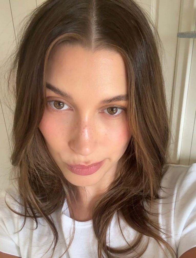 Hailey Bieber pokazala lice bez šminke i otkrila kako smiruje upale na koži