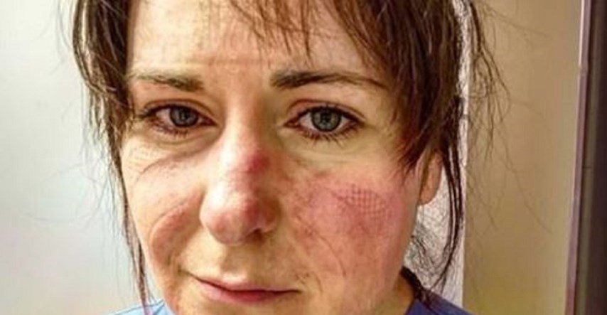 Potresna fotografija medicinske sestre: "Kad poželite izaći, sjetite se ovoga lica"