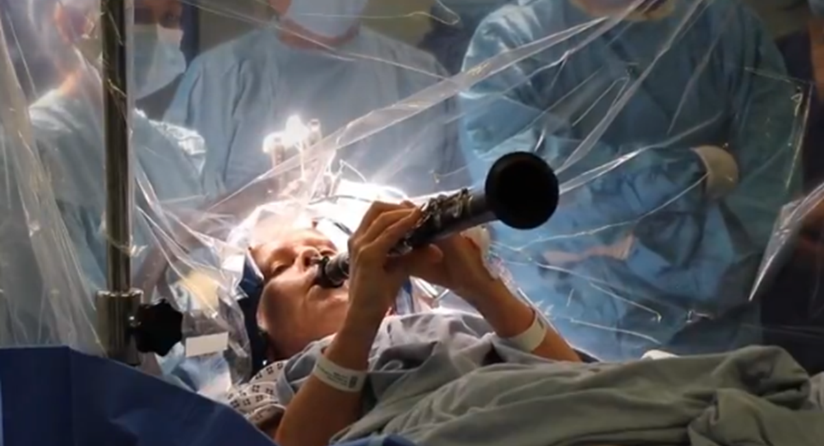 Britanka svirala klarinet tijekom operacije mozga