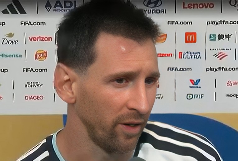 Messi pokazao veliku kvrgu na čelu nakon što je spasio Argentinu od šoka