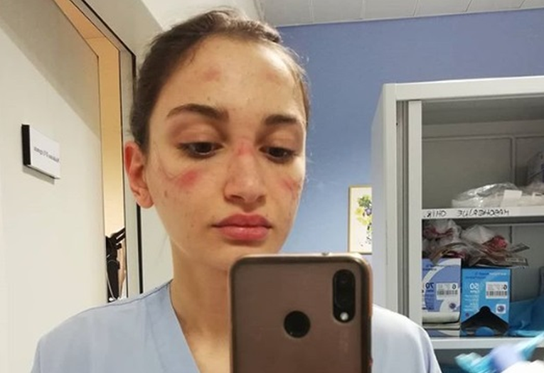 Medicinska sestra iz Italije objavila selfie s posla, pogledajte joj lice