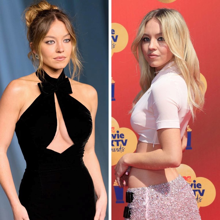 Glumica odgovorila na glasine o estetskim operacijama: "Dostojanstveno ću starjeti"