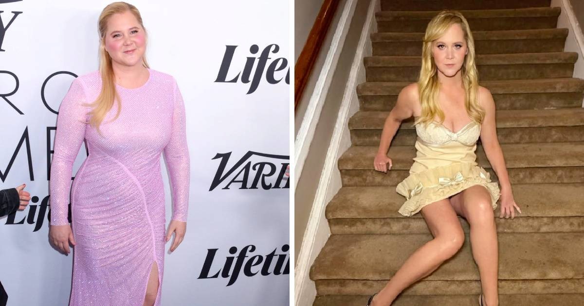 Amy Schumer drastično smršavjela, krenule glasine o razvodu