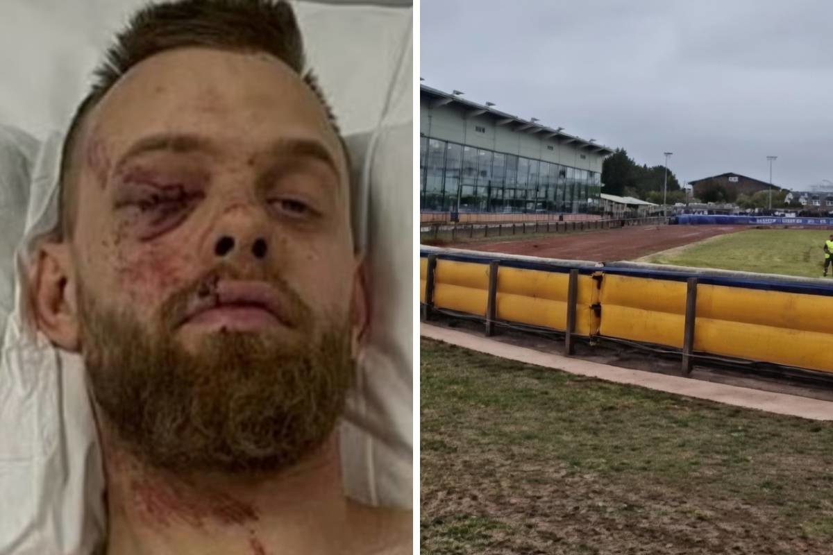 VIDEO Vozač motora stradao na utrci. Slomljena su mu noga i rebra, a pluća probušena