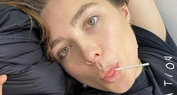 Florence Pugh se onesvijestila zbog pirsinga u nosu, objavom upozorila fanove