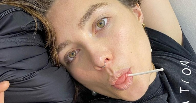 Florence Pugh se onesvijestila zbog pirsinga u nosu, objavom upozorila fanove