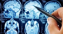 Svaka nova memorija oštećuje moždane stanice, tvrde znanstvenici