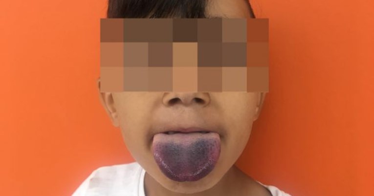 Dječaku se jezik zaglavio u boci, a liječnik ga oslobodio briljantnim trikom