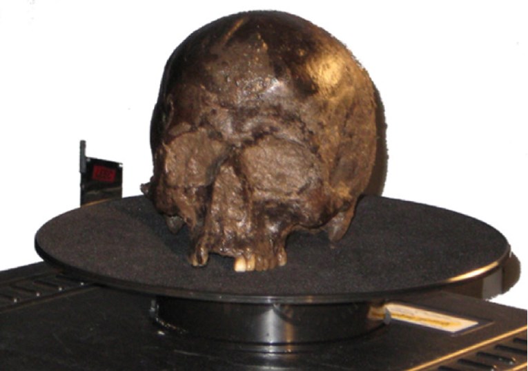 U Britaniji nađen mozak star 2600 godina, čovjek je ubijen na brutalan način