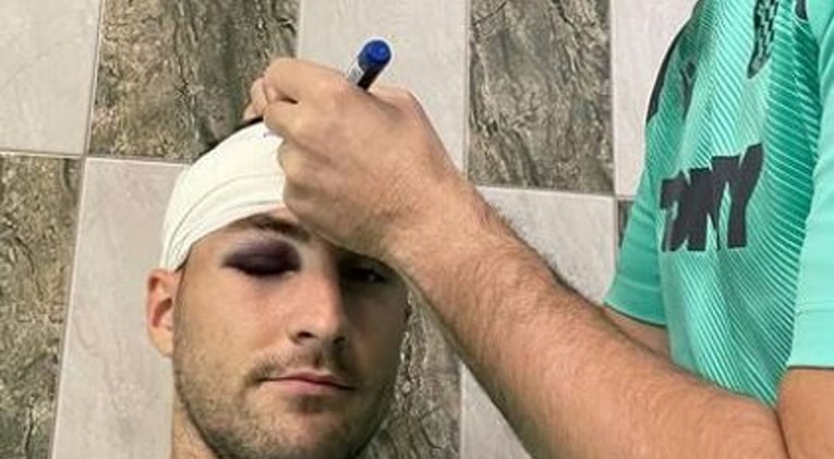 Subašić ozlijeđenom suigraču: Kad brat igra, pucaju glave