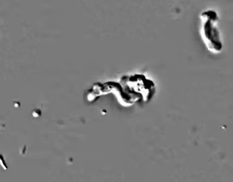 VIDEO Otkrivena "vatrena ameba". Složeni organizam koji preživljava na 63 °C