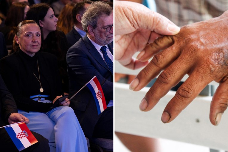 HDZ-ova ministrica: Nije bilo potrebe da javnost zna o gubi