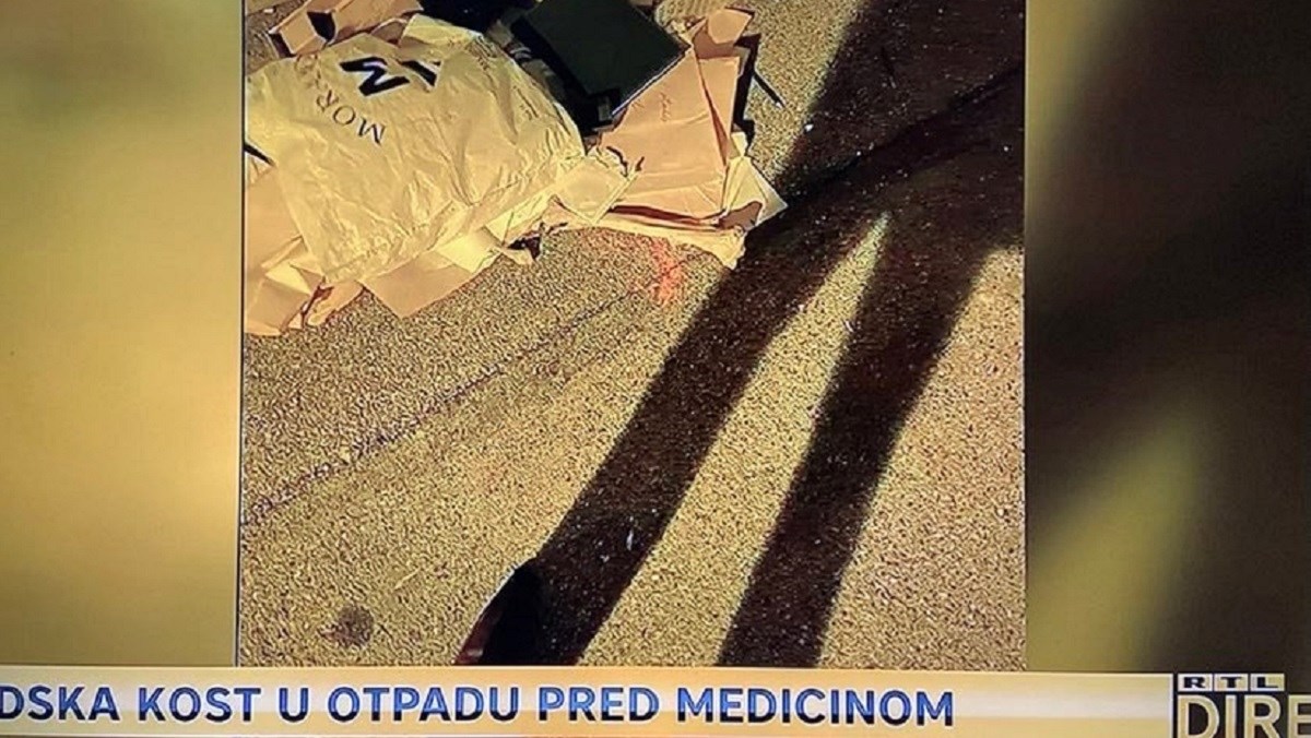 Student tvrdi da je kod Medicinskog fakulteta u Zagrebu našao ljudsku kost