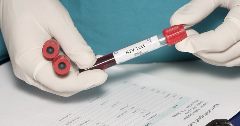 Što su znanstvenici naučili iz drugog poznatog izlječenja od HIV-a?