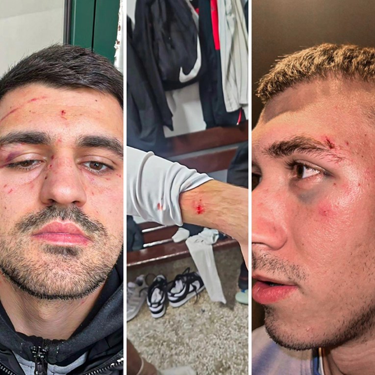 Igrači Metkovića napadnuti u Orebiću, predsjednik ugrizao protivnika za oko?
