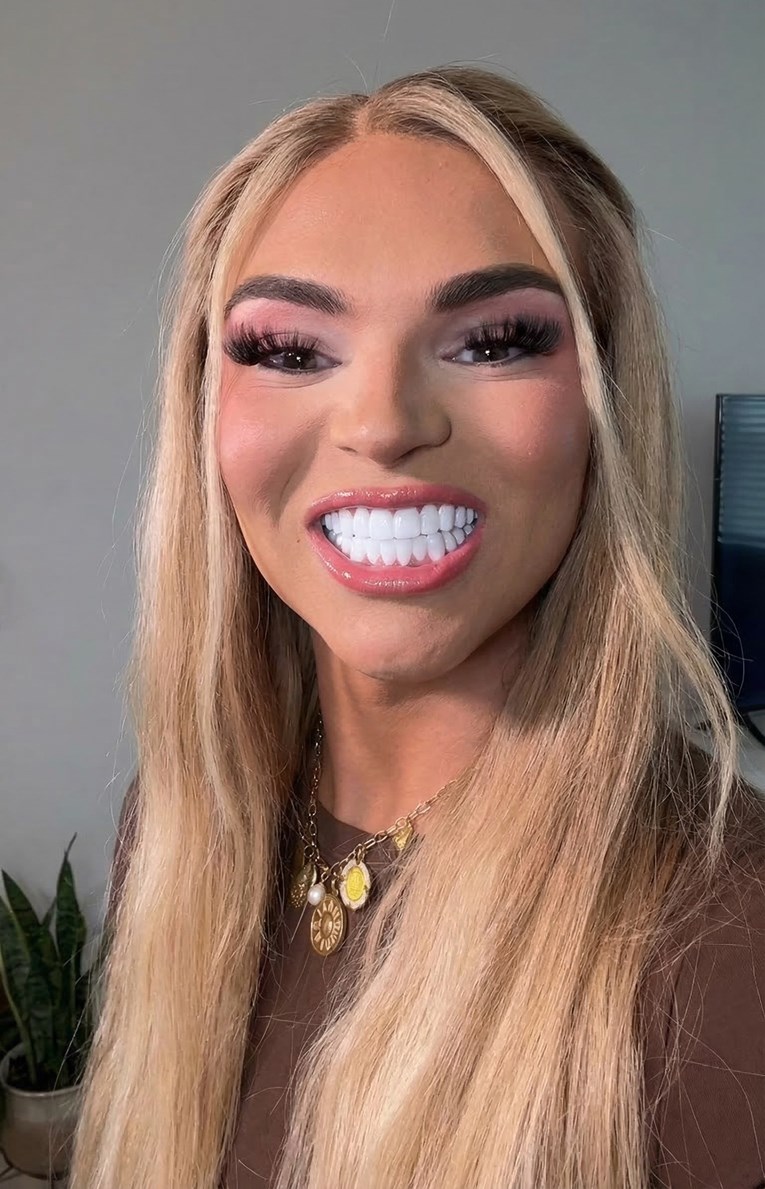 Platila ljuskice 17.000 eura, sad joj se rugaju da ima konjske zube