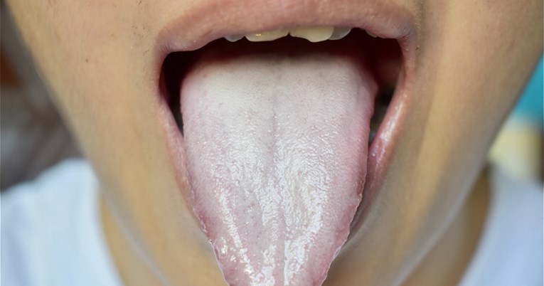 Okus metala u ustima: Zašto se javlja i kada može biti znak za brigu?