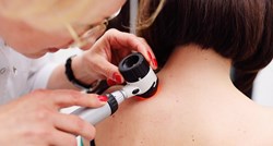 U danu otkriveno 10 melanoma na Korčuli i Pelješcu
