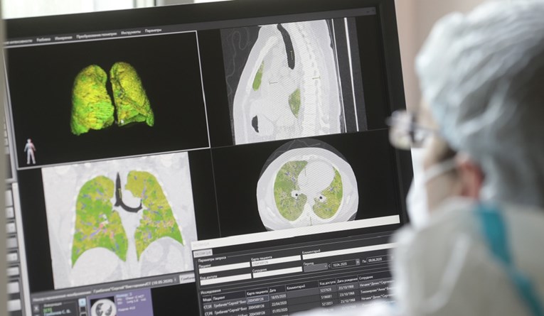Britanska studija: Omikron manje uspješno napada pluća