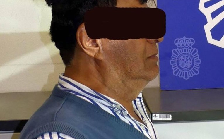 Kolumbijac nosio pola kile kokaina pod tupeom - morate vidjeti kako je izgledao
