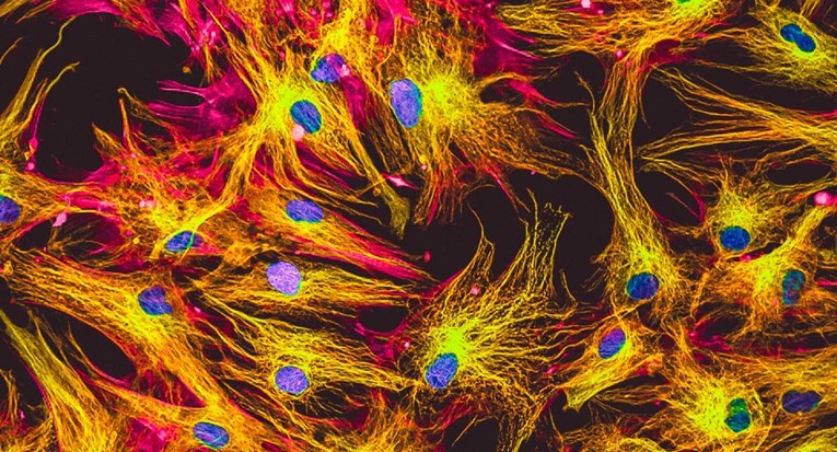 Znanstvenici pomladili stanice kože za 30 godina