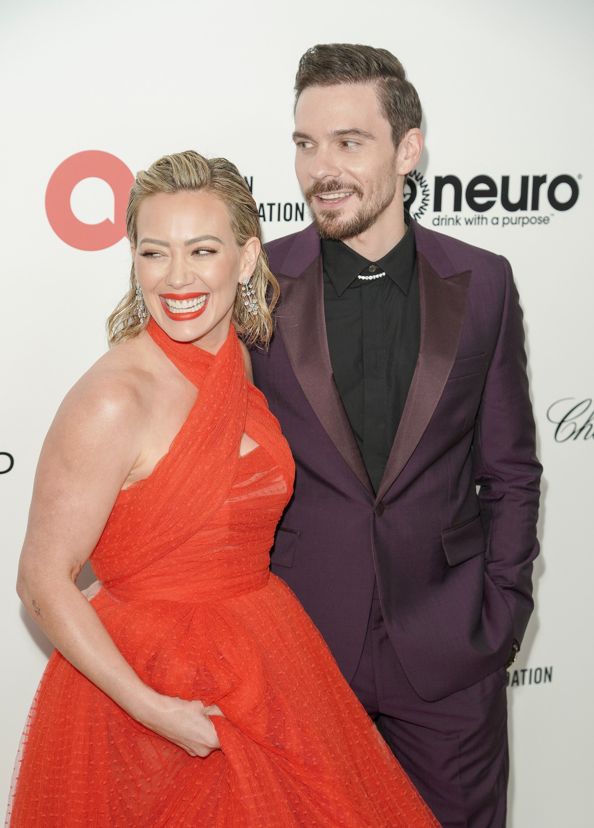 Hilary Duff kritiziraju da koristi botoks, suprug odgovorio hejterima: "Odjebite"