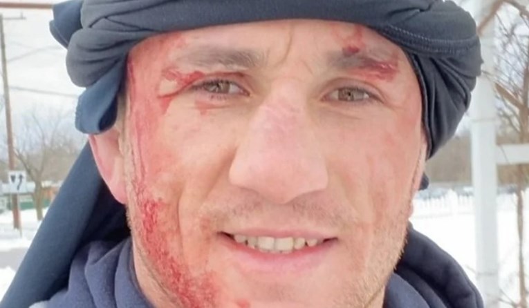 VIDEO UFC-ov borac skočio na glavu u zaleđeno jezero. Završio je u bolnici
