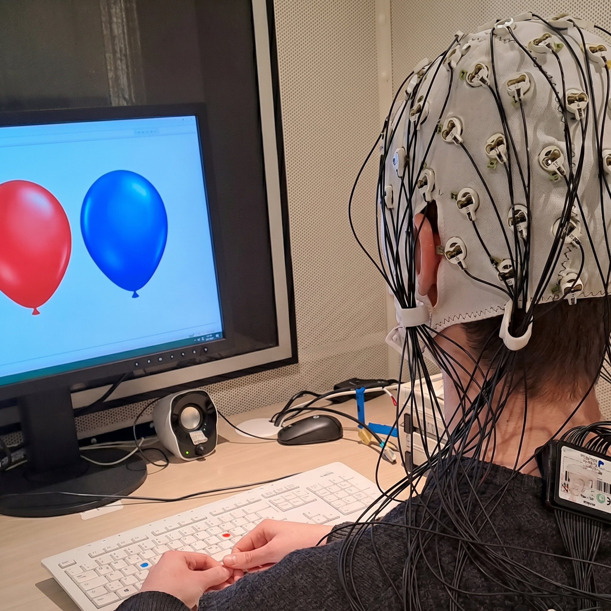 Otkriveno kako ljudski mozak donosi odluke