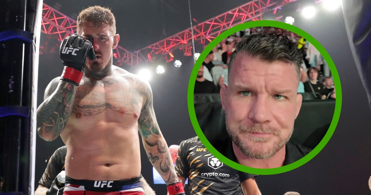 Legenda izgubila oko u borbi, sad predlaže UFC pravilo. "Najjednostavnije rješenje"