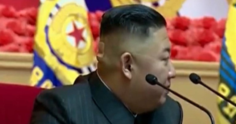 Kim Jong-un došao na sastanak s flasterom na glavi, govorka se o njegovom zdravlju