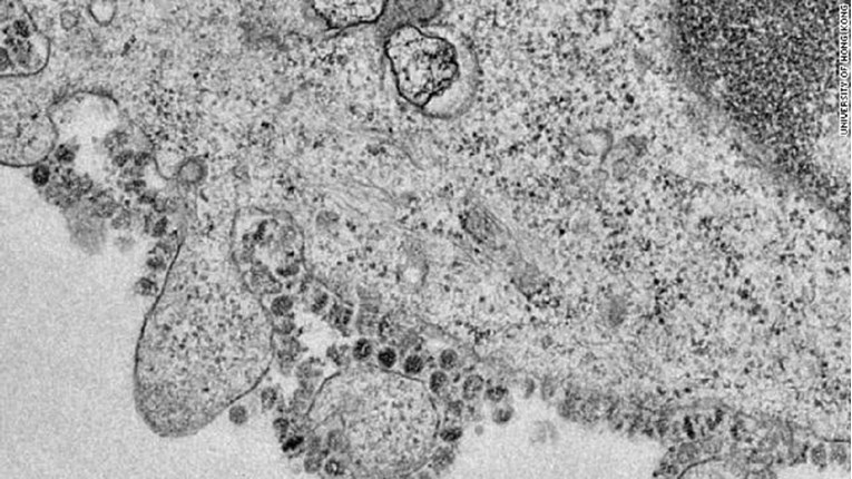 Sveučilište u Hong Kongu objavilo slike umnožavanja koronavirusa