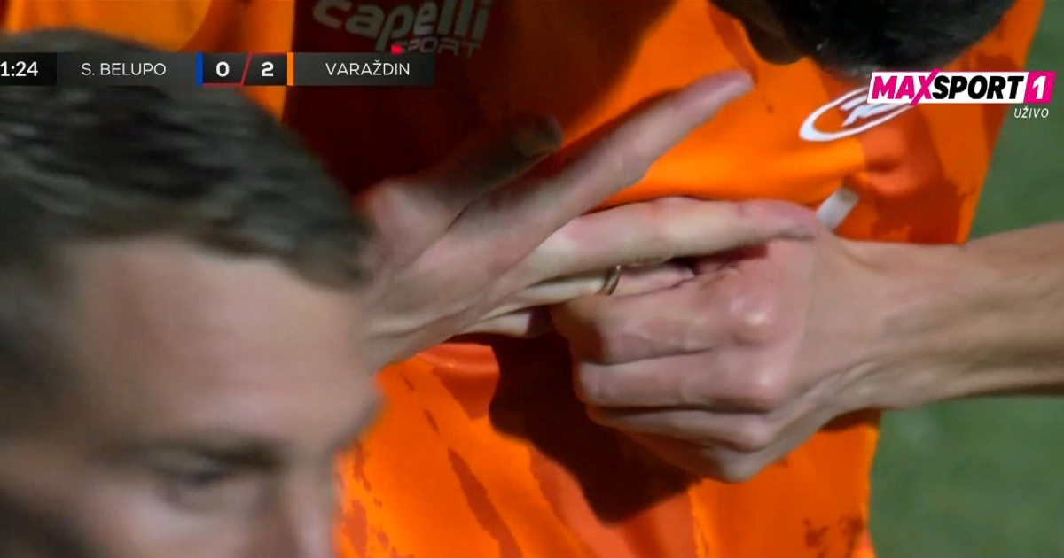 Bizarnost u SHNL-u. Igrač Varaždina zaboravio skinuti prsten prije ulaska u igru