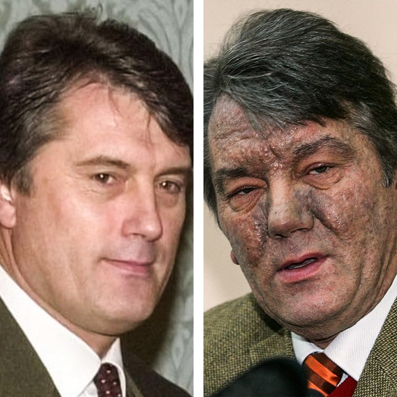 Lice mu je postalo sivo, morfij primao kroz kateter... Evo kako je otrovan Juščenko