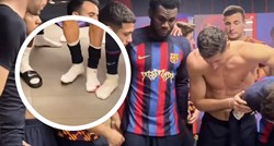 Igrači Barce užasnuto gledali nogu Lewandowskog nakon El Clasica