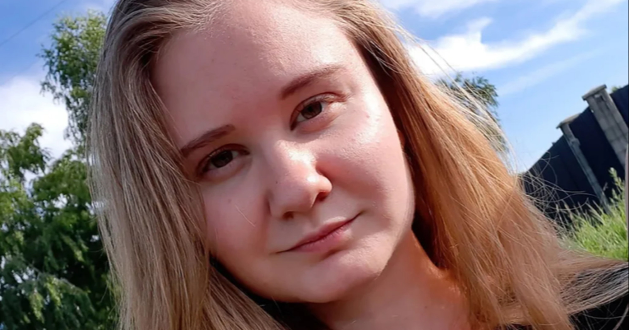 Ruskinja umrla nakon teške upale pluća, sumnja se na kugu. Reagirala Amerika
