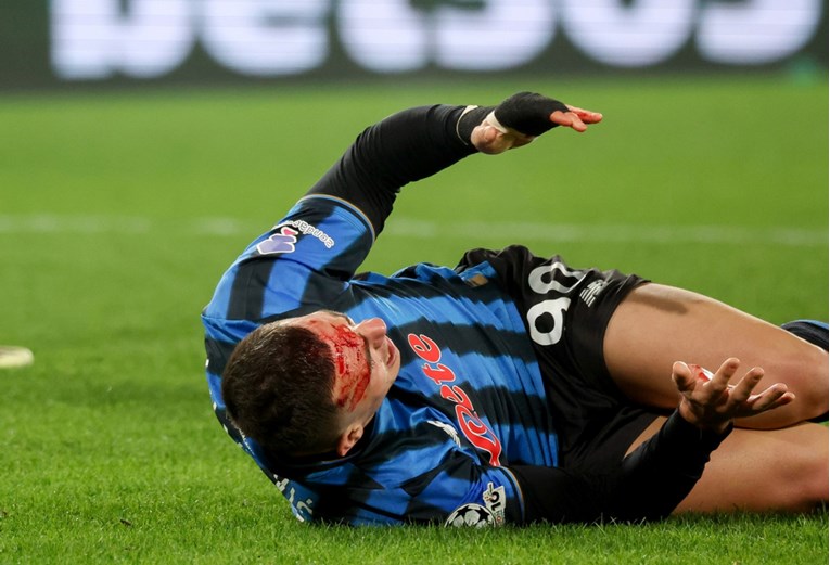 Dobio je udarac kopačkom u glavu i odveo Atalantu dalje. Evo kako izgleda nakon meča