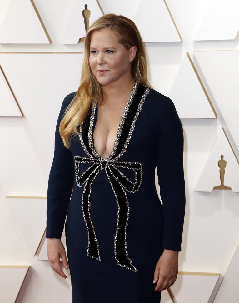 Amy Schumer o borbi s endometriozom: "Godinama sam živjela s nevidljivom boli"