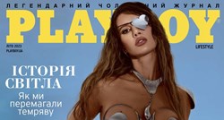 Supruga ukrajinskog političara, koja je u napadu ostala bez oka, pozirala za Playboy