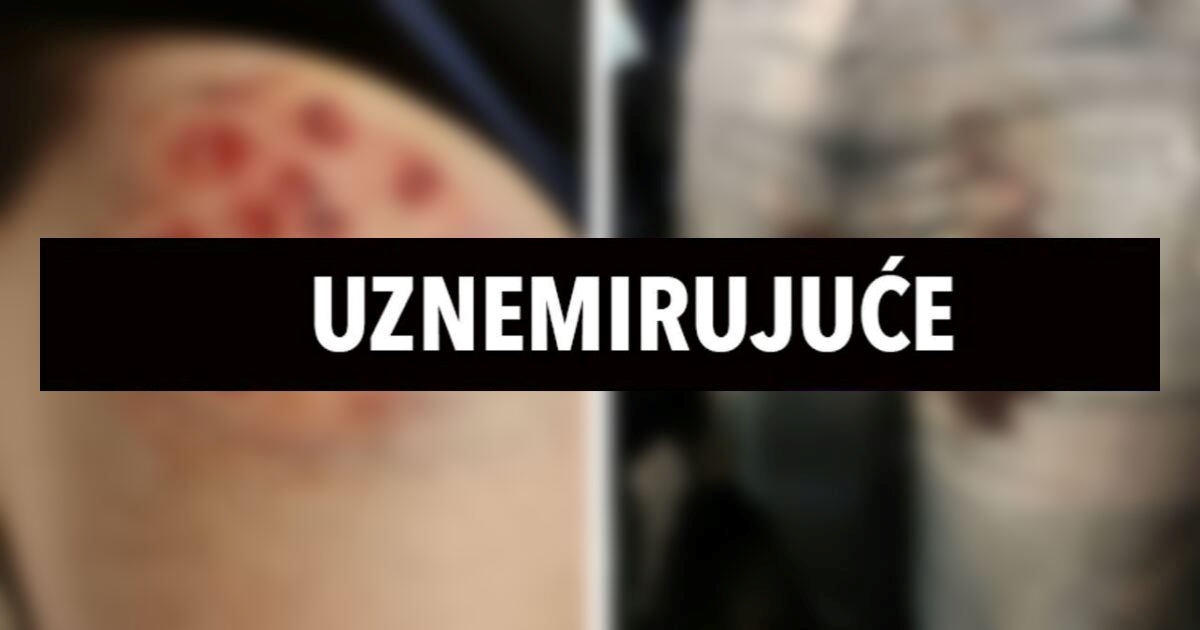 FOTO Portugalska policija pucala na Delije. Ovo su posljedice
