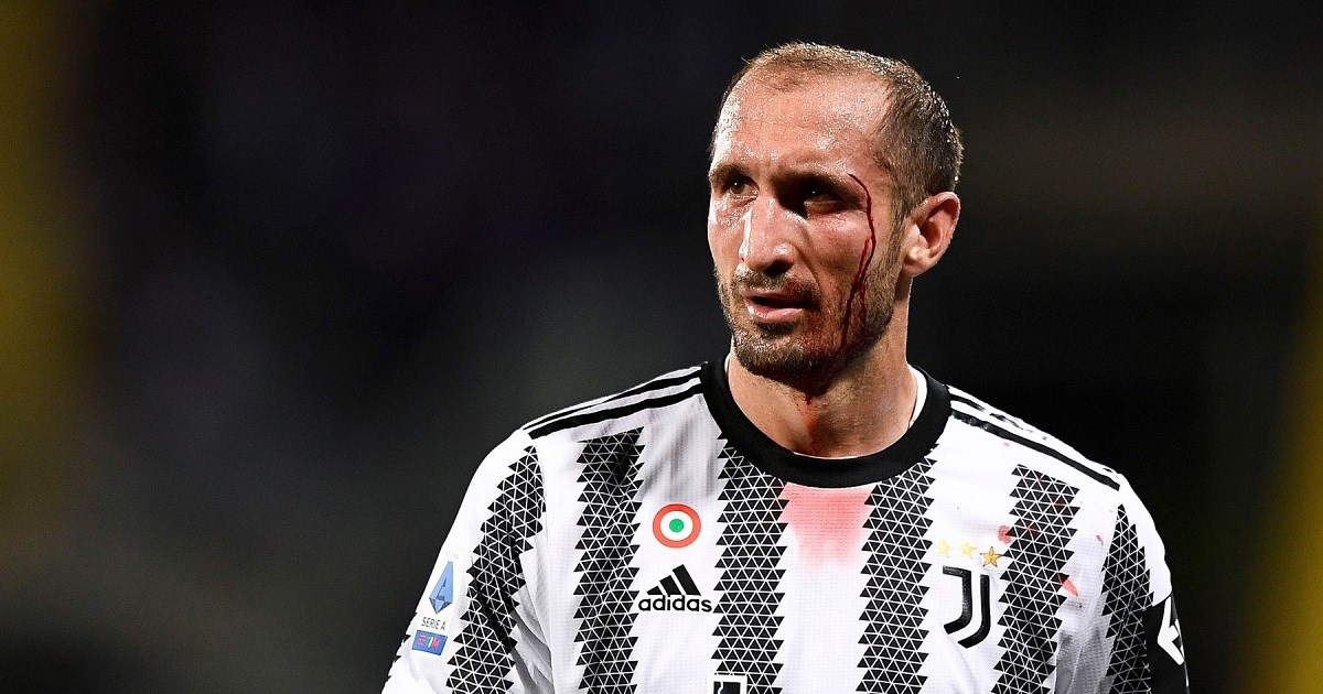 Chiellini je i zadnji put prokrvario za Juventus